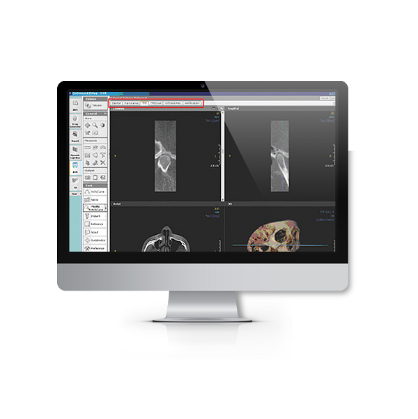 Програмное обеспечение Cybermed OnDemand3D Server + 6 DENTAL лицензий 901031 купить