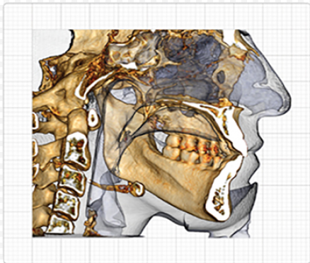 Програмное обеспечение InVivo 3D Ceph Analysis / Модуль для 3D цефалометрии 0.830.5354 купить
